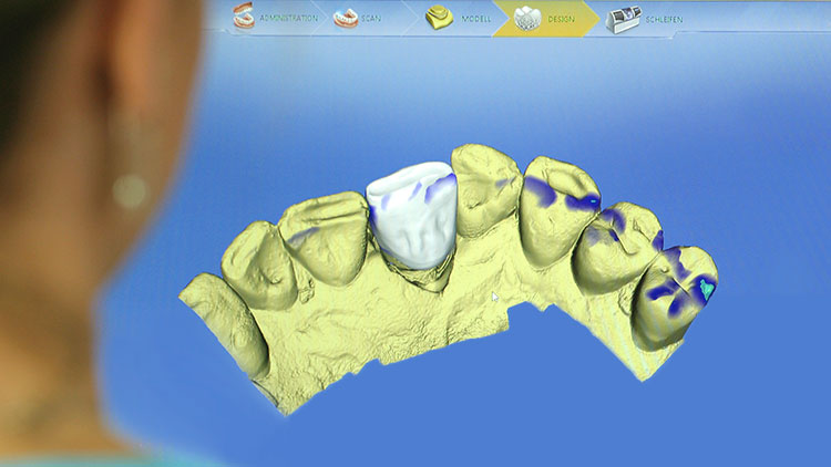 Labor, computergestützter Zahnersatz, CAD/CAM, Technologie